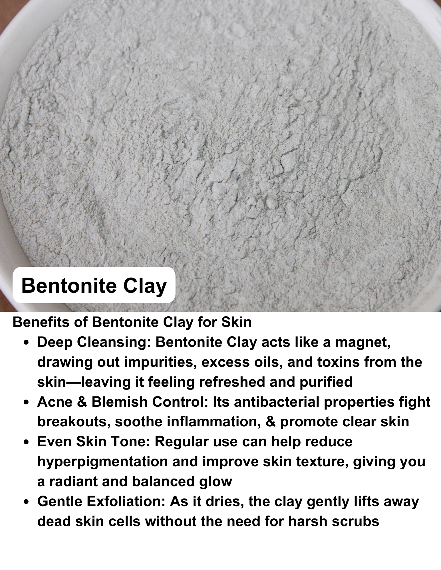 Cleansing Bar for Acne